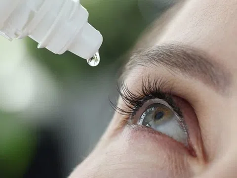 Mờ, khô và mỏi mắt, nên chọn thuốc nhỏ mắt như thế nào?