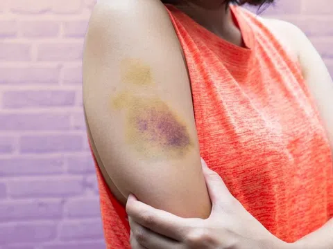 Những dấu hiệu trên da cảnh báo bệnh nguy hiểm