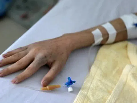 Ca đầu tiên ở Việt Nam chữa ung thư máu bằng liệu pháp đắt đỏ