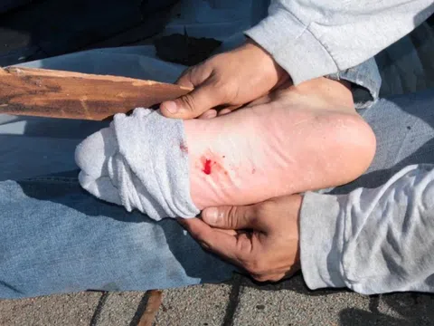 Người lớn có cần tiêm vaccine uốn ván?