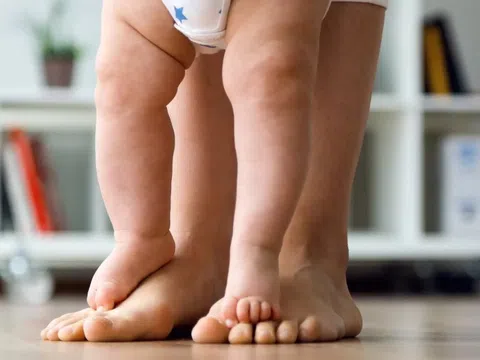Nguyên nhân khiến trẻ bị còi xương