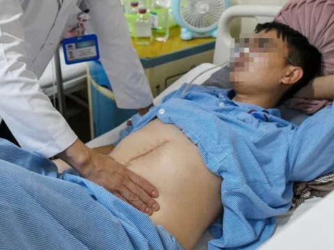 Mắc ung thư đại trực tràng ở tuổi 25