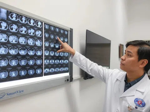 Ung thư đại trực tràng ở người trẻ tuổi ngày càng gia tăng