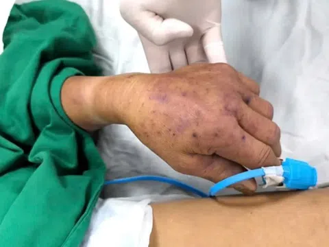 Biểu hiện bất thường sau bữa ăn cảnh báo bệnh nguy hiểm