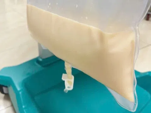 Huyết tương trắng như sữa vì thói quen đàn ông Việt thường làm