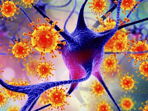 Sốt cao và đau đầu, đi viện được bác sĩ phát hiện lý do bất ngờ