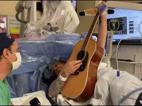 Ca mổ não đặc biệt, bệnh nhân vừa tỉnh vừa chơi guitar