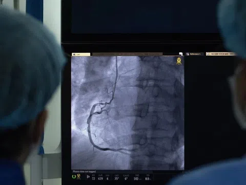 Căn bệnh 'hạ gục' giới trẻ Việt, 1/4 người trưởng thành đang mắc