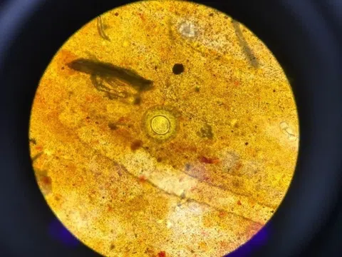 Triệu chứng mơ hồ dễ bị bỏ qua của bệnh sán dây nhỏ