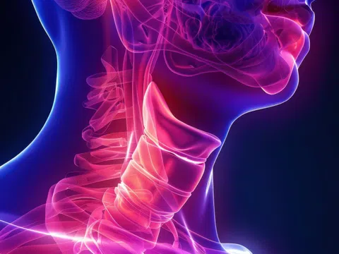 Những thói quen âm thầm dẫn tới ung thư vòm họng