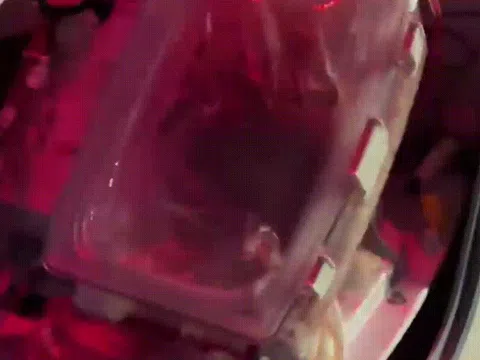 Hình ảnh gây sửng sốt về cơ thể con người