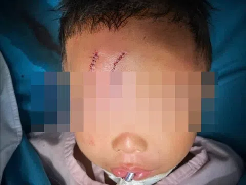 Bé trai ở TP.HCM bị chó becgie cắn thương tâm