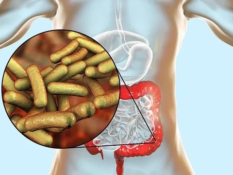 Cảnh giác với bệnh lỵ mùa mưa bão