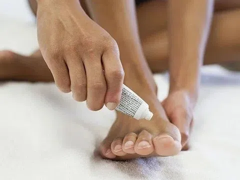 Ngứa, bong vảy, nấm da sau mưa điều trị thế nào