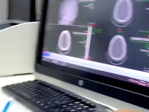 Gia đình bệnh nhân nghi bác sĩ tắc trách, bệnh viện nói chỉ thiếu sót khi in kết quả ra viện