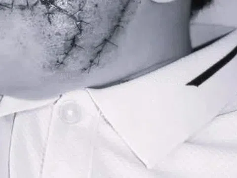 Đang chơi trong sân, bé trai bất ngờ bị chó lạ lao vào cắn