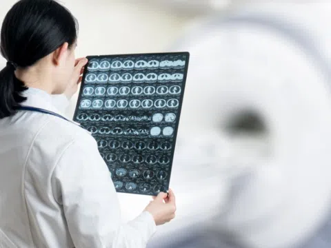 Não đàn ông 'teo' nhanh hơn phụ nữ