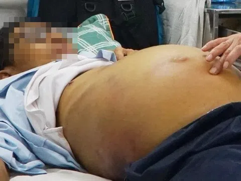 Bẽ bàng sau khi nhai vội viên An Cung phòng đột quỵ