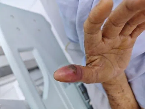 Rắn độc bò vào nhà vệ sinh, tấn công người đàn ông ở TP.HCM