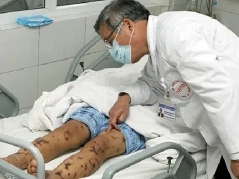 Thiếu niên 16 tuổi ở TP.HCM mắc bệnh có thể cướp mạng chỉ sau 24 giờ