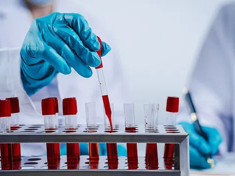 Bốn xét nghiệm nên thực hiện sau tuổi 40 để sống khỏe mạnh hơn