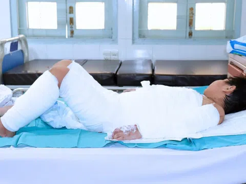 Bé trai bị bỏng thương tâm vì một sự cố bất ngờ