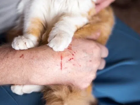 Bé trai 11 tuổi bị mèo cưng trong nhà cào, phải nhập viện phẫu thuật