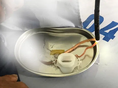 Cảnh tượng trong tá tràng bệnh nhân khiến bác sĩ Phú Thọ sốc