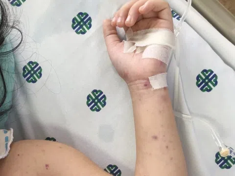 HCDC cảnh báo căn bệnh nguy hiểm, có thể không qua khỏi sau vài giờ