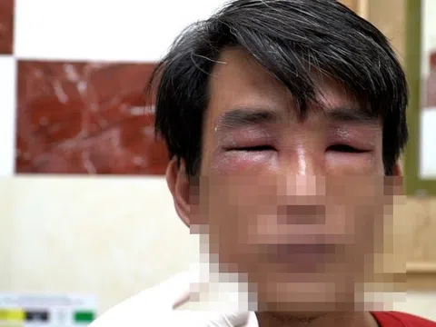 Kiến ba khoang tấn công người ở TP.HCM