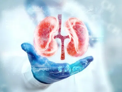 4 điều đơn giản giúp sức khỏe thận tốt lên mỗi ngày