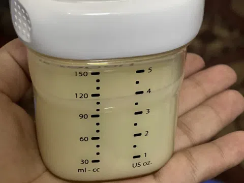 Sữa mẹ không phải thực phẩm đơn thuần mà tiềm ẩn mầm bệnh nếu vắt, trữ không đúng