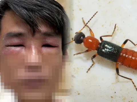 Con vật bé bằng hạt thóc có độc tố mạnh gấp 15 lần nọc rắn hổ mang