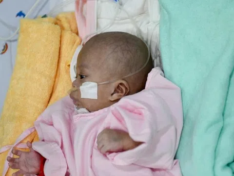 Nguyên nhân hàng đầu gây tử vong ở trẻ sơ sinh