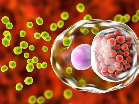 Quan hệ đồng giới không an toàn, nam thanh niên viêm họng do tác nhân hiếm gặp