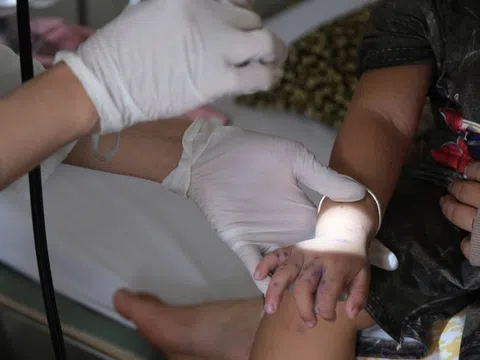 Bệnh tay chân miệng tăng nhanh ở nhiều tỉnh thành miền Tây