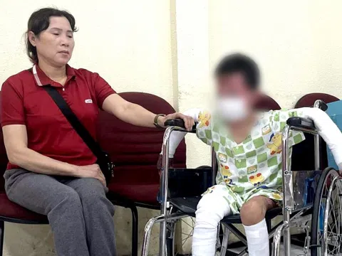 Cứu bệnh nhi phỏng 65% cơ thể trong vụ phóng hỏa ở Gia Lai làm 2 người tử vong