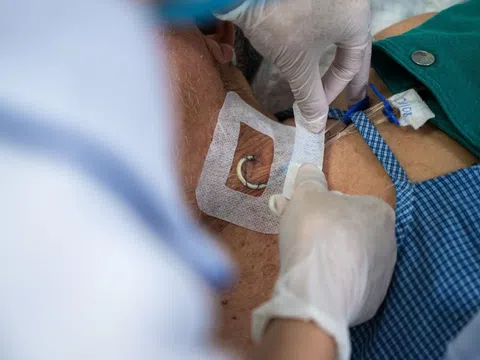 Điểm chung của những ca đột quỵ tại Việt Nam