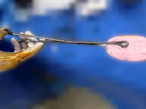 Bác sĩ cảnh báo xu hướng đáng lo gia tăng ở nhóm trẻ gái 10-16 tuổi