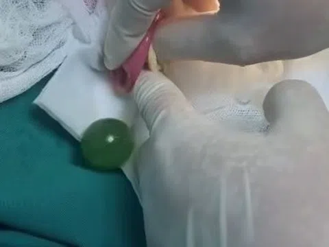 Bố mẹ bất ngờ khi biết lý do khiến con trai ăn gì nôn nấy suốt 2 ngày