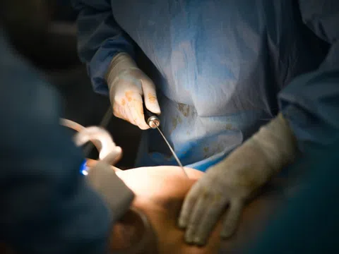 Gia đình tan vỡ, vợ chồng ly hôn sau phẫu thuật thẩm mỹ