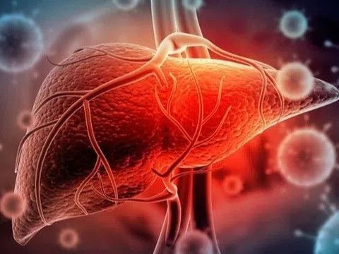 Triệu chứng âm thầm báo hiệu mắc viêm gan B