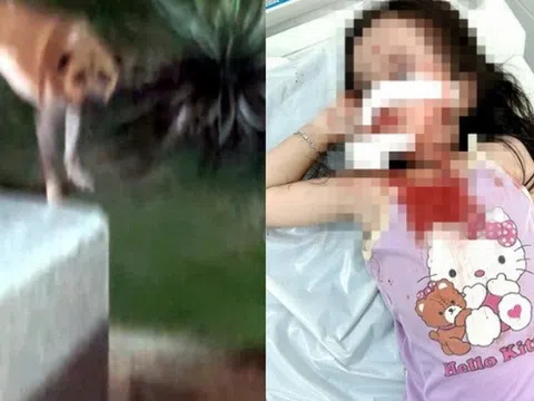 TP.HCM: Bé gái bị chó tấn công, thương tích nghiêm trọng vùng mặt