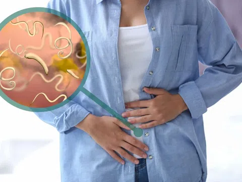 5 dấu hiệu bạn đã nhiễm ký sinh trùng, không nên chủ quan