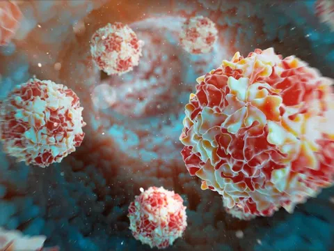 Lào ghi nhận ổ dịch bại liệt, Bộ Y tế họp trực tuyến toàn quốc