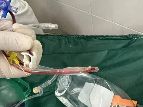 Bé 3 tuổi ở TP.HCM tử vong ở nhà trẻ, bác sĩ chỉ ra sai lầm chí mạng