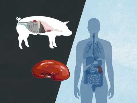 Vì sao Mỹ ghép tạng heo cho người nhưng cấm tạo tạng người trong heo?