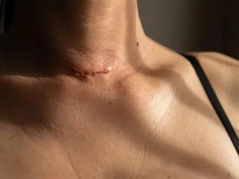 Một bệnh ung thư dẫn đầu ca mắc ở TP.HCM, chuyên gia chỉ ra lý do