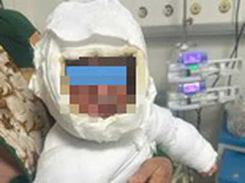 Bé 9 tháng tuổi bỏng 30% cơ thể vì kéo dây điện ấm siêu tốc