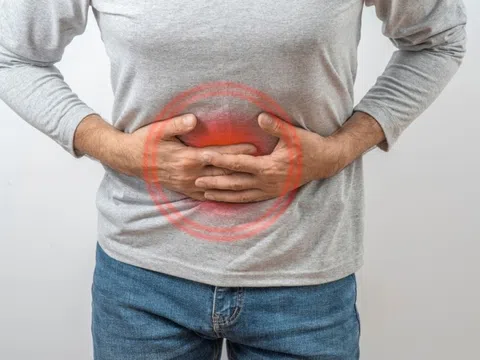 Thủ phạm quen mặt khiến người Việt trẻ mắc ung thư đại tràng